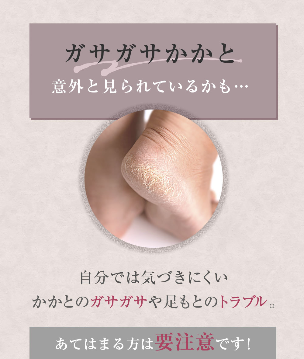 ガサガサかかと意外と見られているかも