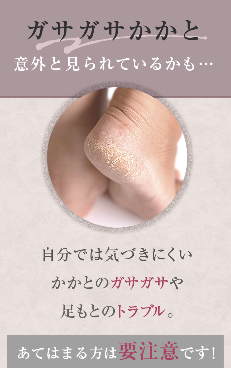 ガサガサかかと意外と見られているかも